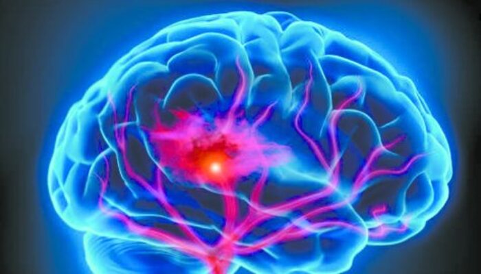 Apa yang Terjadi di Otak Saat Kita Sedang Fokus