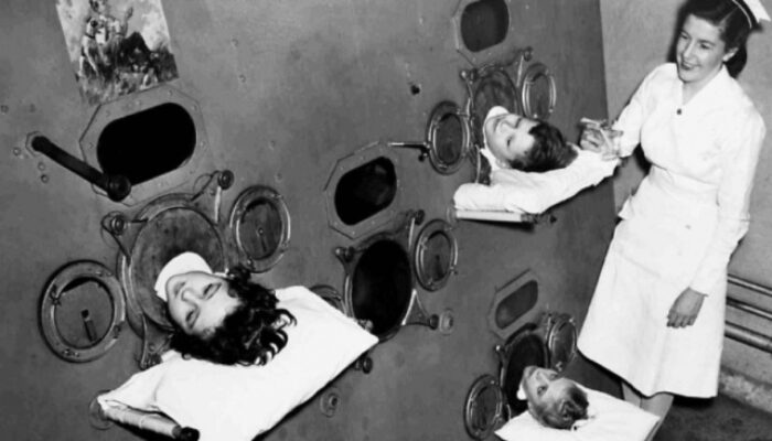 Bikin Merinding! Dulu Alat Medis Ini Lebih Mengerikan dari Film Horor