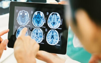 Kanker Otak Paling Mematikan Bisa Mati Hanya Dengan Pil