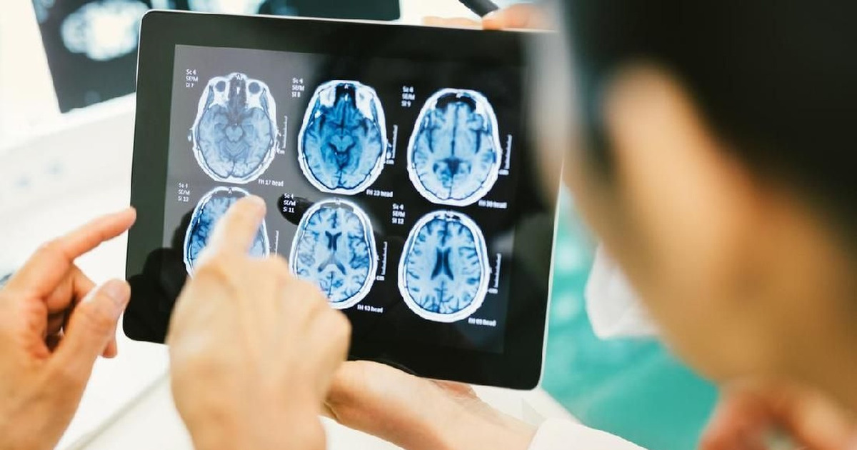 Kanker Otak Paling Mematikan Bisa Mati Hanya Dengan Pil