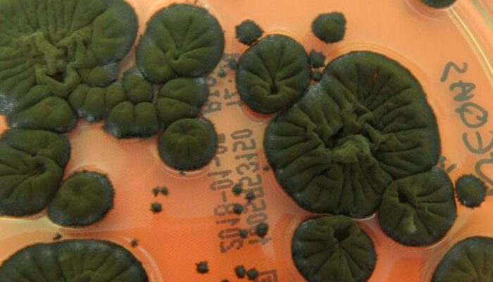 Jamur Super Chernobyl Mengubah Radiasi Jadi Energi