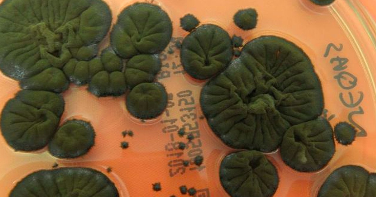 Jamur Super Chernobyl Mengubah Radiasi Jadi Energi